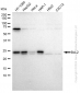 KD-Validated Anti-Bcl-2 Rabbit Monoclonal Antibody
